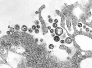 A transmission electron micrograph (TEM) of a number of Lassa virus virions adjacent to some cell debris.