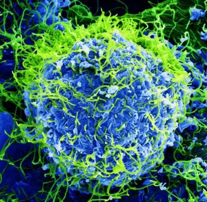 Ebola Virus, electron micrograph