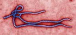 Ebola micrograph
